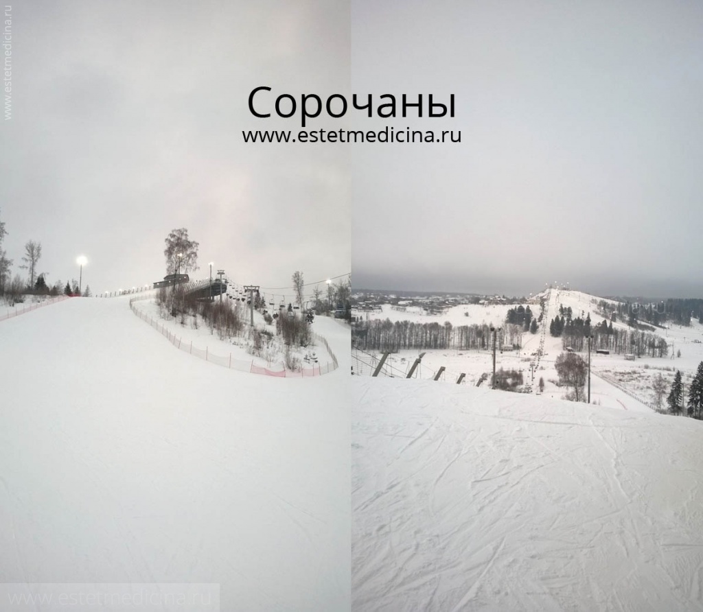 Сорочаны: лыжи, сноуборд, фото, отзывы