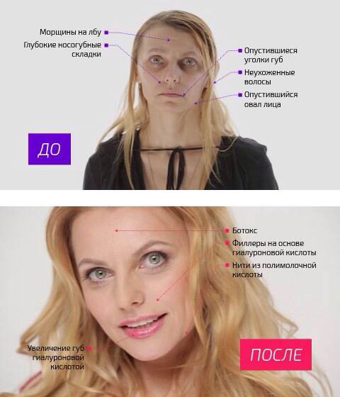 На 10 лет моложе Рен ТВ участница 3