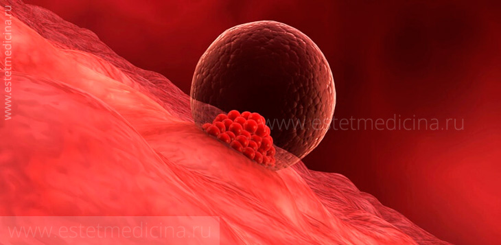 Нет беременности при ЭКО? Разберемся в причинах.