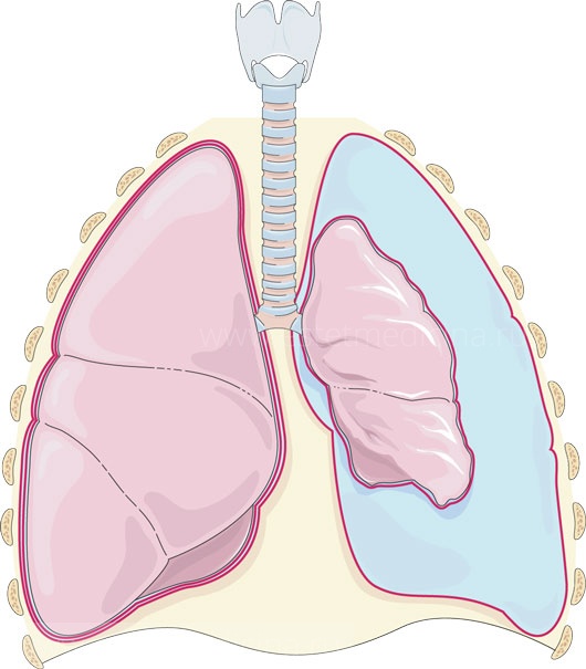 Пневмоторакс. Особенности диагностики и лечения