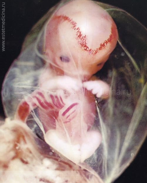 Первый триместр эмбрион
