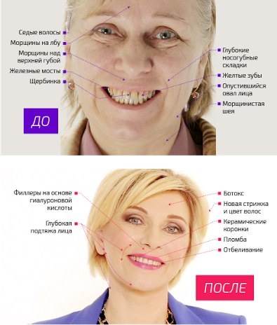 На 10 лет моложе Рен ТВ участница 1 На 10 лет моложе Рен ТВ участница 1