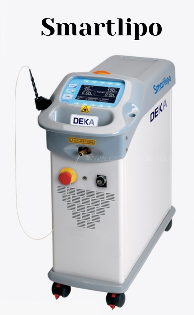 Smart lipo аппарат для лазерной липосакции от Deka