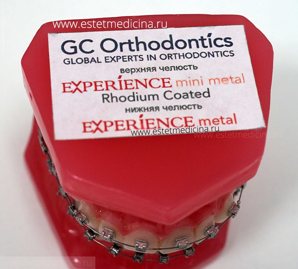 Experience система. Experience Mini Metal GC Orthodontic. Брекеты экспириенс с родиевым покрытием.