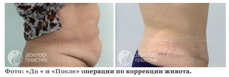Живот до после Баков В.С.