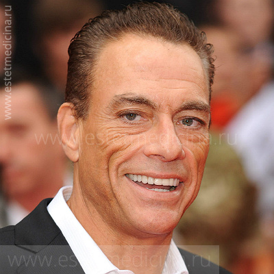 Jean-Claude Van Damme скелетизация брыли