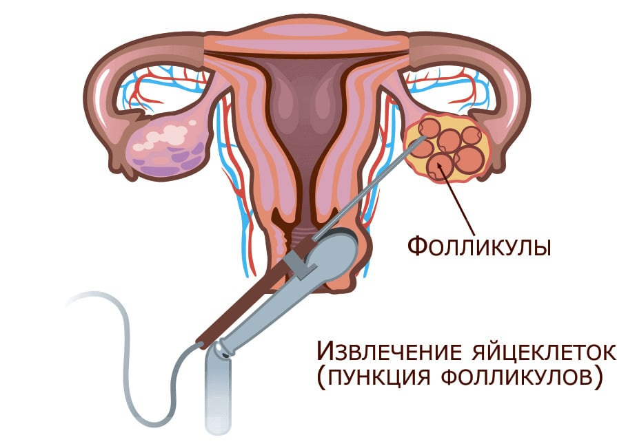 Почему происходит остановка развития эмбрионов? | клиника ДАХНО