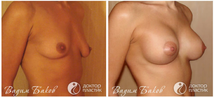 Хирург Баков до и после 2