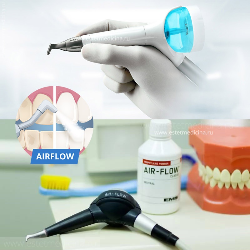 Airflow style pro. Air Flow АИР флоу. Профессиональная чистка зубов. Профессиональная чистка зубов этапы.