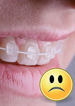 Перелечивание в ортодонтии