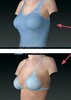 3D моделирование груди у д-ра Свиридова