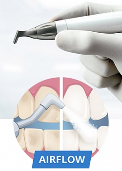 Какие процедуры должны входить в проф. чистку зубов?