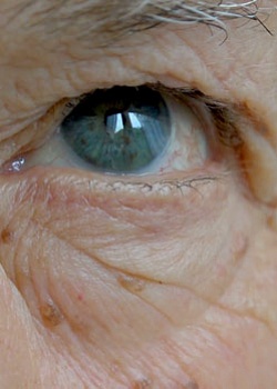 Как лечится катаракта? Эксперт - Олег Унгурьянов