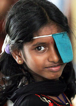 Аравинд - индийский пример оказания офтальмологической помощи